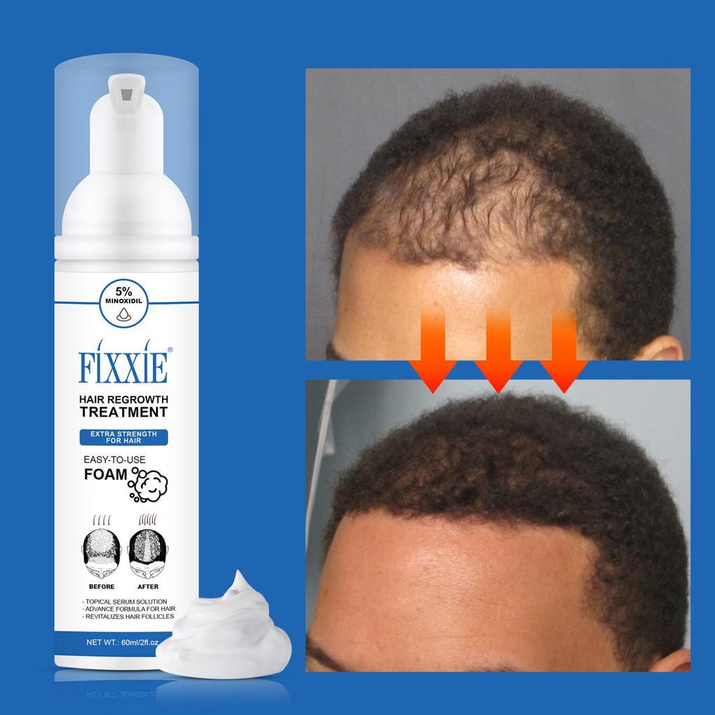 Hair Growth Foam - Fuller